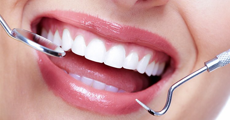 Teeth Whitening Myths
